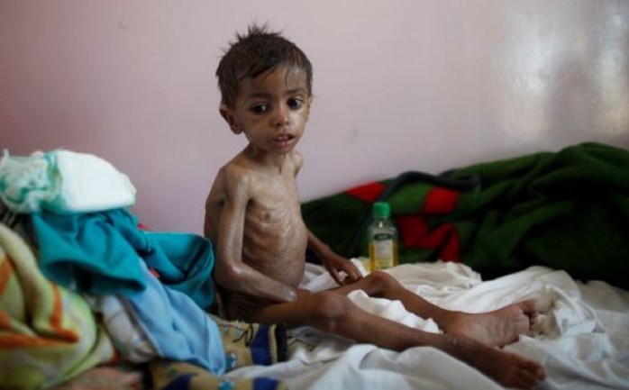 أكدت منظمة رعاية الطفولة التابعة للأمم المتحدة &quot;يونيسيف&quot; أن مليوني طفل في اليمن يعانون من نقص حاد في التغذية.

