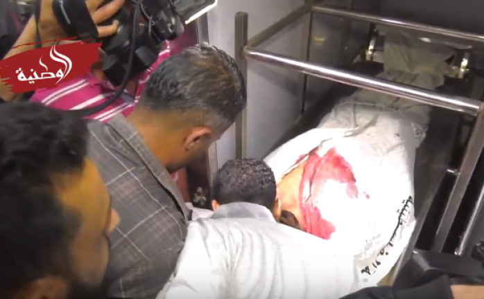 3 شهداء وإصابات باستهداف الاحتلال مناطق متفرقة من قطاع غزة