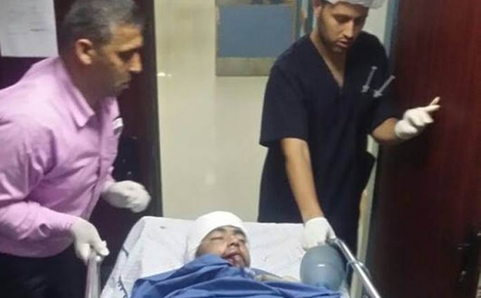 أصيب فتى بجروح بالغة الخطورة، جراء إطلاق النار عليه من قبل جنود الاحتلال الإسرائيلي المتمركزين على الشريط الحدودي شمال غرب بلدة بيت لاهيا، شمال قطاع غزة الجمعة