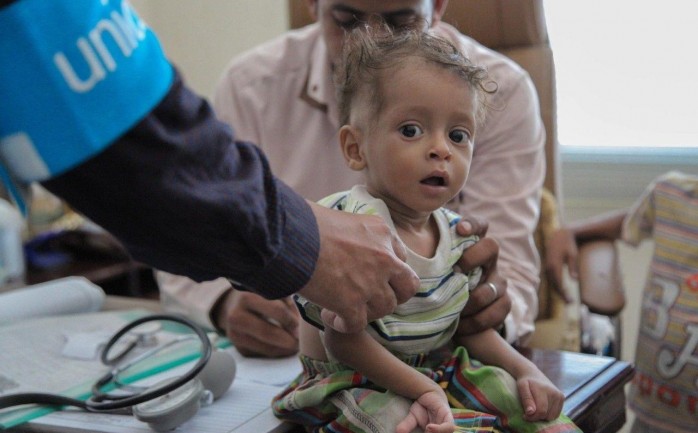 أحد أطفال اليمن مصاب في الكوليرا