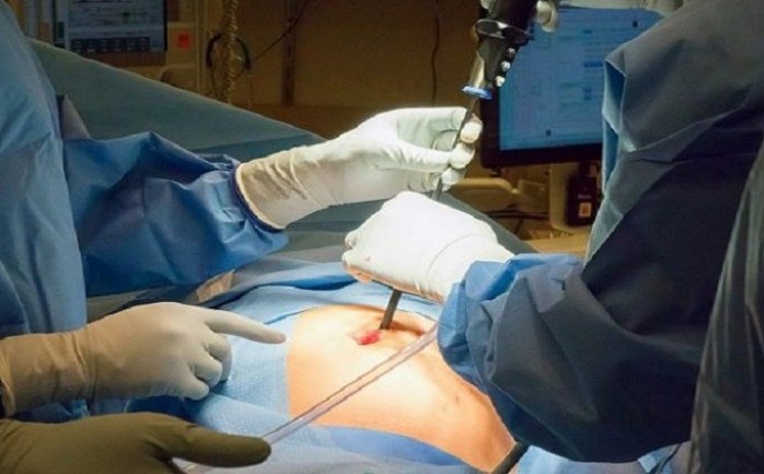 اقتطع الأطباء اليابانيون ورم غريب بطول سنتيمترات في مبيض فتاة يابانية تبلغ من العمر 16 عاما خلال إجراء عملية إزالة الزائدة الدودية.

