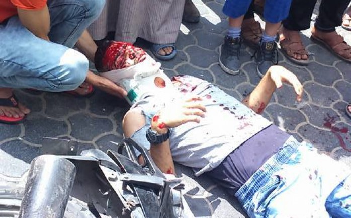 أصيب شابين بغزة اليوم الثلاثاء، إثر تعرضهما لحادث سير في شارع النصر غرب المدينة.

وقال مدير الاستقبال في مجمع
